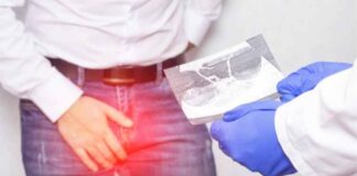 A review of the risks associated with adult circumcision